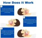 Anti-Snore Mouthpiece - Image 4