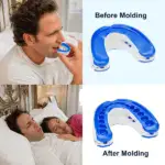 VitalSleep Anti Snoring Mouthpiece - Image 5
