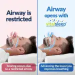VitalSleep Anti Snoring Mouthpiece - Image 6